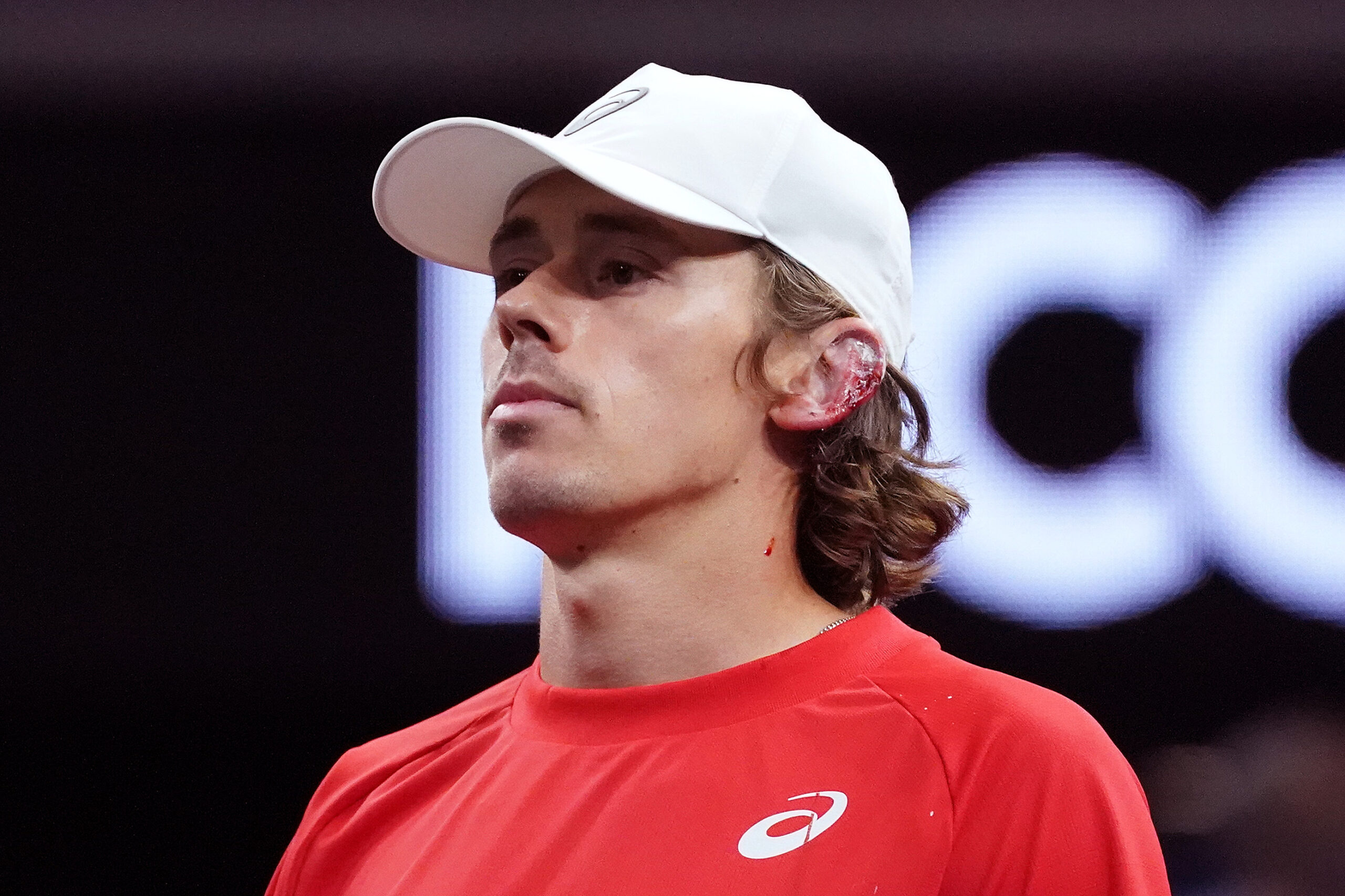 Sep 20, 2025; San Francisco, CA, USA;  Team World Player Alex de Minaur injures his ear after hitting it with his racket during a doubles match against Team Europe players Holger Rune and Casper Ruud at the Laver Cup at Chase Center. Mandatory Credit: David Gonzales-Imagn Images